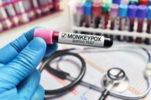 Investigación viruela del mono