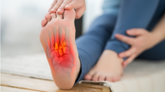 La fascitis plantar es una de las dolencias más comunes del verano